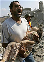 child_injured_in_israeli_attack_on_the_gaza_strip__file_2007.jpg