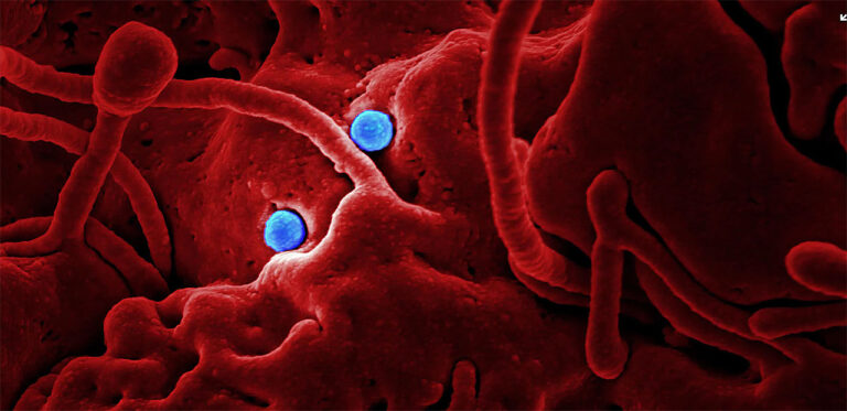 Veksten i nye smittede går ned – 832 døde på en dag