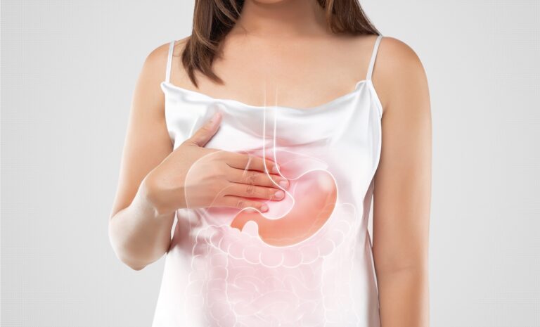 Spiserørskreft er tretti ganger hyppigere hos pasienter med Barretts øsofagus