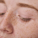 Young female face with freckles