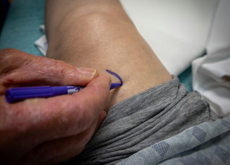 Bare 1 % kjenner løsningen. Derfor går tusenvis rundt med åreknuter uten å vite det